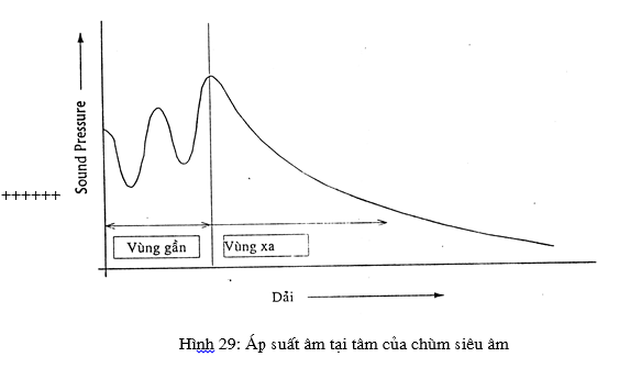 Hình ảnh cho tìm kiếm chùm siêu âm mối hàn